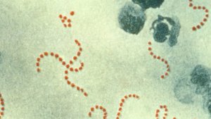 El impétigo es una enfermedad infecciosa bacteriana causada por estreptococos.
